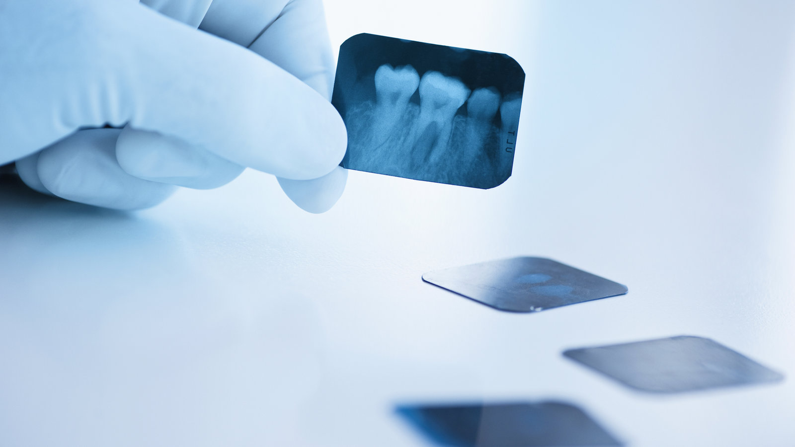 Rehabilitación Oral